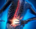 Best ayurveda treatment for low backache