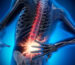 Best ayurveda treatment for low backache